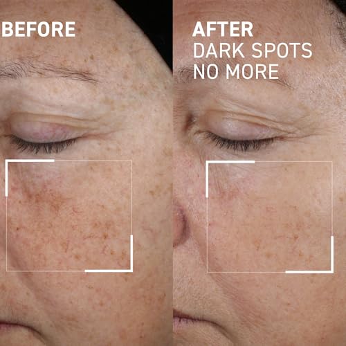 Dr. Brandt Bright This Way Dark Spots No More - 0.5 fl oz, Pack of 2 - Reduces Number, Intensity & Size of Pigmented Spots