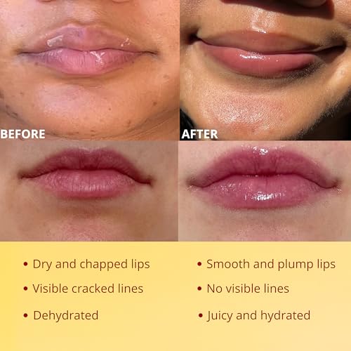 Original My Bee Balm Lip Balm ? Hydrating Lip Care with Watermelon, Strawberry & Honey Pot ? Moisturizing Balm for Dry, Chapped & Cracked Lips with Propolis, Honey & Vitamin E