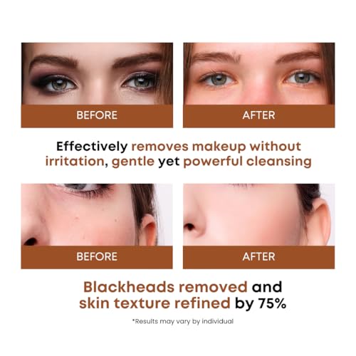 Rice Water Cleansing Pads ? Makeup Remover Wipes & Korean Toner Pads with Centella Asiatica, Exfoliating for Blackhead Removal & Pore Minimizer, 50 Pad