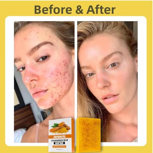 Lemon Turmeric & Kojic Acid Soap Bar For Dark Spot ? lightening Skin with Vitamin C - 3x Moisturizing with Shea Butter for Face / Body?Natural ingredien Glowing Soap for Oily & Dry Care - 3 Pcs