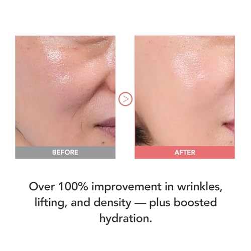 107% Smoother Crow¡¯s Feet & 104% Lifted Skin ? Boosts Elasticity & Moisture ? Firms & Restores Radiance with 10% Collagen Water & Hyaluronic Acid ? Korean Skincare Best Collagen Cream