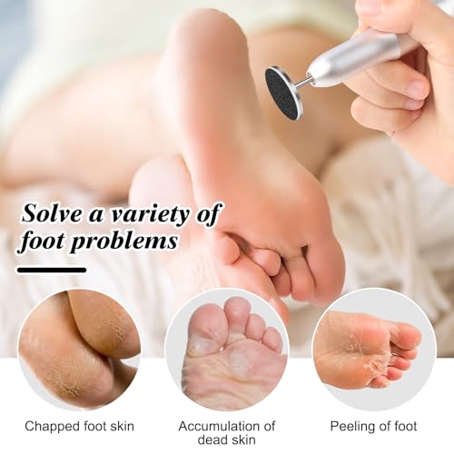 120 Pcs Sanding Paper Disc w/ 2 Metal Bit, 80/120/180/240 Grit Round Pedicure Replacement Sanding Discs for Electric Nail File Bits, Foot File Sandpaper Discs for Dead Skin Foot Callus Remover