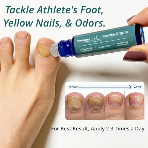 Swissklip Medi-Care Toenail Stick I KlearNail Treatment | Natural Solution for Healthy Nails I Suitable For Foot, Toe, and Fingernail I For Brittle Toenails ? 10ml / 0.3 Fl. Oz. Pack 3 - Made in USA
