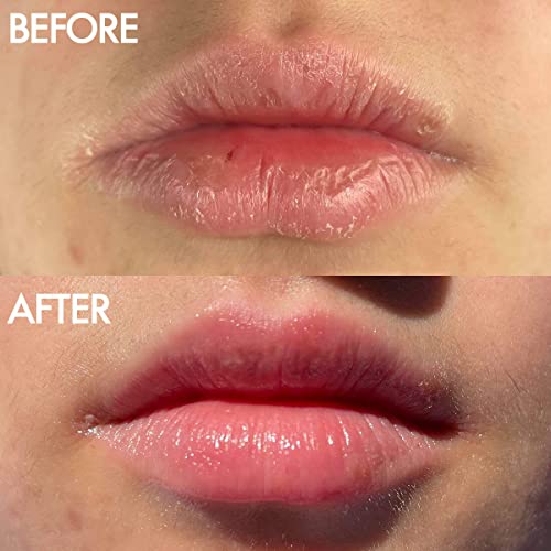 Lanolips 101 Ointment - Lanolin Lip Balm for Smooth, Hydrated & Healthy Lips - Multipurpose Lip Ointment with Lanolin Oil for Dry Lips, Cuticles & More - Coconutter (0.35 oz)