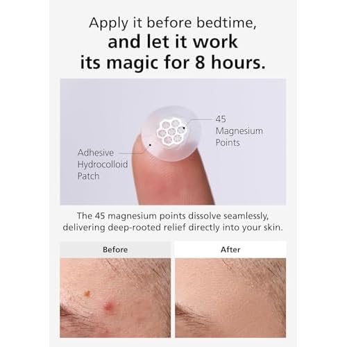 EasyDerm Quick Calming Magnesium Patches ? 40 Patches (4 Pack), Hydrocolloid Acne Spot Treatment with Tea Tree & Cica, Bulk Value Pack for Acne-Prone Skin, Ideal for Home Skincare