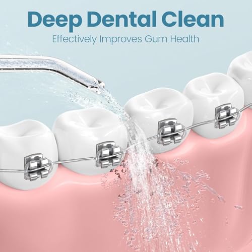 Onlyone Water Dental Flosser Replacement Heads Oral Irrigator Refill Heads Jet Tips 5 Pieces: Only Compatible for Onlyone Water Dental Flosser