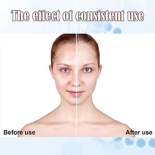 BB Facial Glow Starter Kit Serum Hyaluronic Acid Essence Skin Care Set, Salmon DNA Glod Ampoule 0.27oz 12 Vials, Glow Repair Kit with 7 Different Peptides