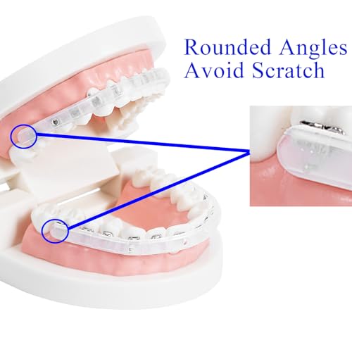 Comfort Cover for Braces, Lip Protector Mouth Guard Lip Cushion Teeth Shield Bumper for Brackets, Aligner, Dental Wax Alternative, Hard and Rigid Clip, in Portable Storage Case with Mirror