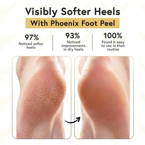 Moisturizing Gel Socks for Men - Extra Large 2 Pairs - Silicone Heel Socks, Cracked Heel Treatment, Reusable Spa Socks with Shea Butter for Dry Skin & Foot Care