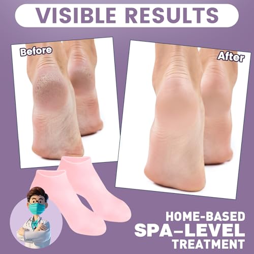 2 Pairs Silicone Socks for Dry Cracked Feet, Women's Foot Socks for Moisturizing (Pink & Beige, Fits Up to Size 9)