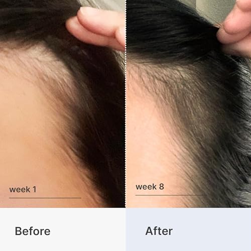 Better Not Younger Hair Thickening Serum for Women Over 40 ? Scalp Care, Hair Density Treatment and Anti-Aging 2fl.oz ? Fortifying Serum with Biotin & Ginger. Promotes Stronger, Thicker-Looking Hair.