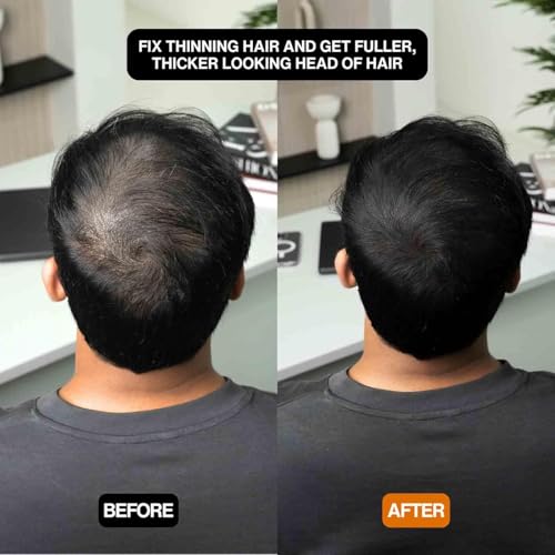 Hairbear Hair Filler, Blissae Hair Filler Powder, HairBear Hair Filler Powder, Natural Hair Thickening Fibers Instant Volume & Scalp Coverage for Thinning Hair (Black)