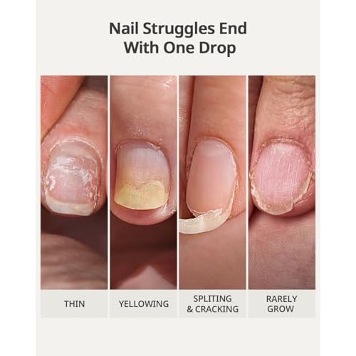 BTARTBOXNAILS Naillush Nail Strengthener & Growth - Repair Damaged Nails, Strengthen Weak & Thin Nails, Extra Strong Nail Growth Treatment, Long Lasting Nail Hardener, 15ml