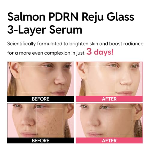 Salmon PDRN Reju Glass 3-Layer Serum, Radiance & Firming Facial Serum with 1% PDRN, Niacinamide, Collagen, Hyaluronic Acid, 30g (1.06 fl oz)