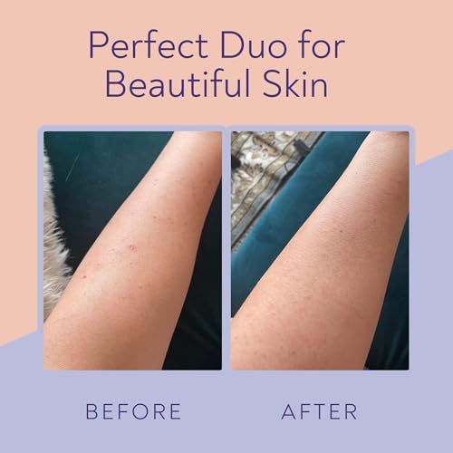 KP Bump Eraser Body Scrub & Keratosis Pilaris Lotion Bundle Set ? Strawberry Legs Treatment for Women - Exfoliates & Deeply Hydrates for Smoother Healthy-Looking Skin