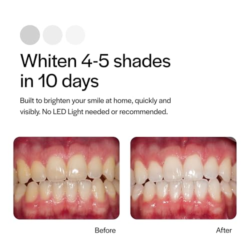 Opalescence Go 15% Mint - Prefilled Teeth Whitening Trays - 4 Treatments (3 Packs) - Made by Ultradent. 4648-3