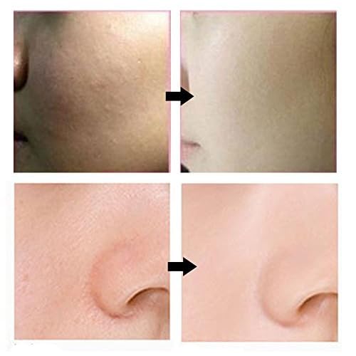 Bergamo] Magic Snail BB Cream 50ml /Intense Care Wrinkle Care Sunblock/Korean Cosmetics