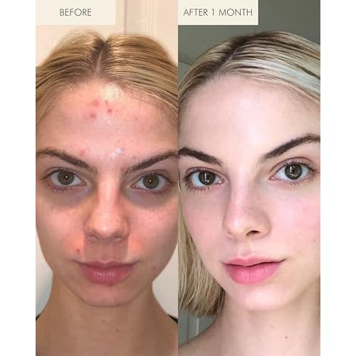 MARA - 1.2% Clean Retinol Face Oil for Anti-Aging + Wrinkles with Algae + Green Tea | Vitamin-Rich Serum to Plump Skin Overnight, For All Skin Types (1 fl oz | 30 ml)