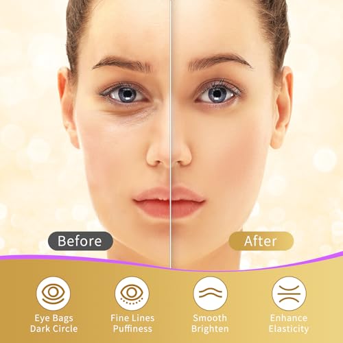 Under Eye Patches, 40 Pairs Eye Mask for Dark Circles, Puffy Eyes, Undereye Bags,Wrinkles,Eye Mask Patches with 24K Gold, Eye Treatment Skin Care for Men & Women Gift