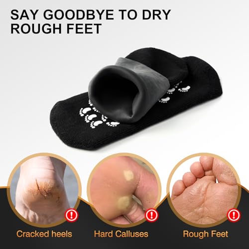 MoyRetty 2 Pairs Moisturizing Silicone Socks for Men - Large Size, Black, Ultimate Aloe-Infused Gel for Home Use - Say Goodbye to Dry Cracked Feet