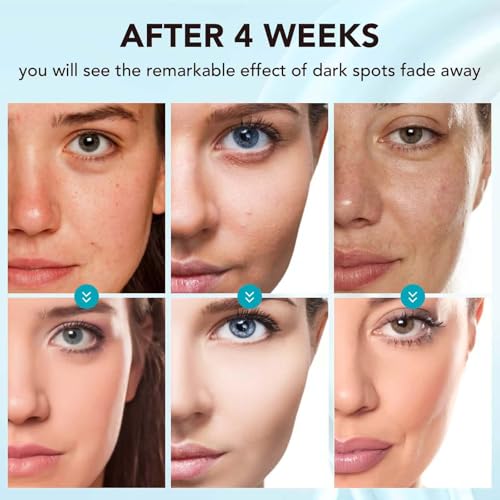 Skin Bleaching Cream, Skin Lightening for Intimate Areas, Moisturizing Cream Contain Vitamin C for Underarm, Armpit, Knees, Elbows, Inner Thighs and Bikini Area (1.7 Fl Oz)