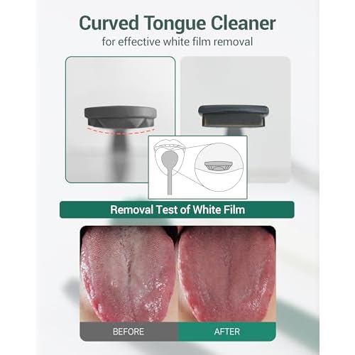 DEARCUS Korean Tongue Scraper with 3 Replaceable Heads - 100% BPA Free TPE Tongue Cleaner - Reduce Bad Breath & Without Hurt - Hygienic Scraper - Modern & Simple Design (White)