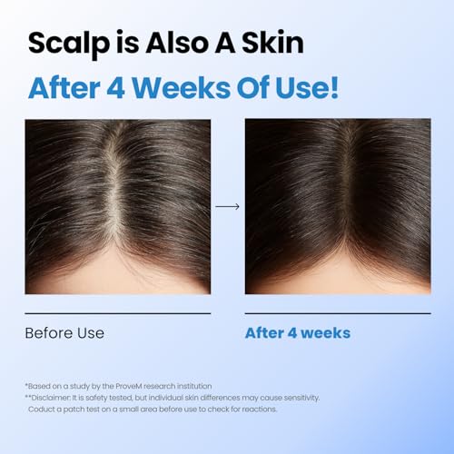 Scalpy Hair Growth Serum for Men & Women for Hair Loss & Thinning | Scalp Treatment with Salicylic Acid, Menthol, Dexpanthenol | Non-Greasy, Lightweight | Exfoliates Dandruff & Soothes Itch