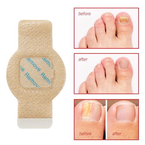 Nail Patches for 8-Hour Overnight Fast Hydrogel Nail Care, Keeps Feet Fresh & Dry All Day ? Men & Women (2)