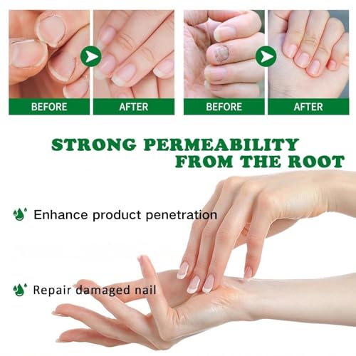 Ginger Nail Treatment, Ginger Cuticle Care Oil for Nails (2 PCS)