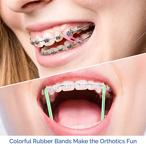JMU Orthodontic Rubber Bands 1/4 Medium 6.4 mm Clear Orthodontic Elastics 4.5oz 500 pack Latex Free Dental Rubber Bands Made in USA