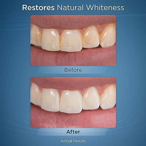 Waterpik Fresh Mint Whitening Refill Tablets (30 Count), Restore Natural Teeth Whiteness, Packaging May Vary, WT-30