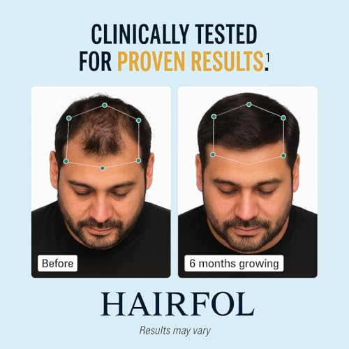 Men's Hair Growth Supplement ? Clinically Tested Hair Growth Vitamins for Men, Thicker Hair & Scalp Coverage, Hair Regrowth Support for Men ? Stronger, Fuller Hair ? 1 Month Supply