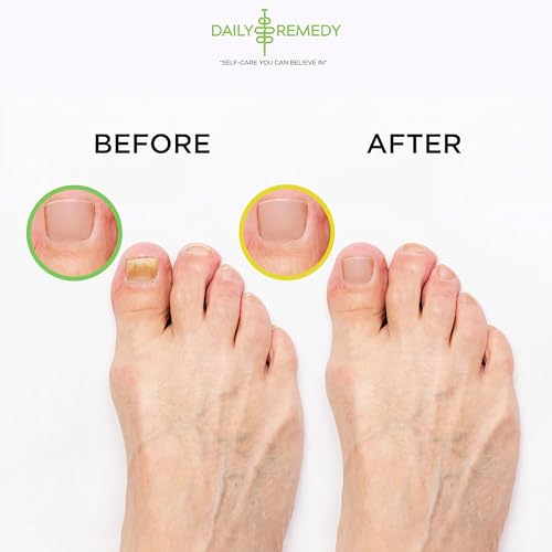 DAILY REMEDY EXTRA STRENGTH Tea Tree Oil & Citrus Detox Foot Soak Set - Made in USA - Soothes Sore Tired Feet, Athletes Foot, Stubborn Foot Odor, Softens Calluses & Refreshes & Detoxifies - Pack of 2