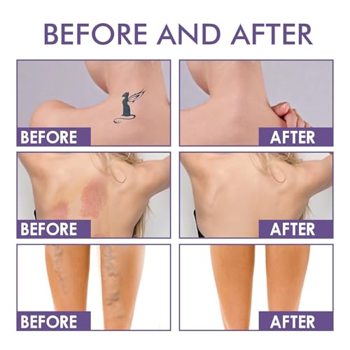 Tattoo Cover Up Makeup, Leg And Body Makeup Waterproof No Transfer,Body Coverage Perfector 2.5OZ