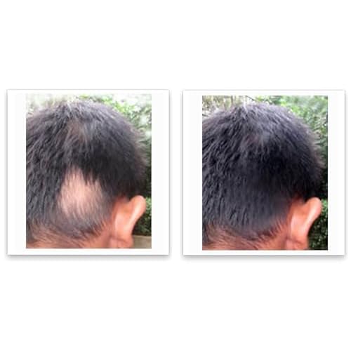 Caboki 10X Volumizing Hair Powder for Thinning Hair: Root Touch Up for Men and Women, Fill in Hairline & Edges, Cover Bald Spots. TALC-Free, Dark Gray