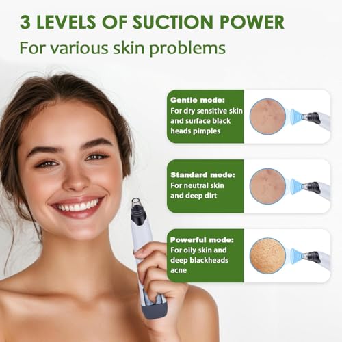 Blackhead Remover Pore Vacuum - Facial Pore Cleaner with 3 Adjustable Suction Levels, 4 Blackhead Removal Tools, Electric Acne Extractor Tool for Women & Men