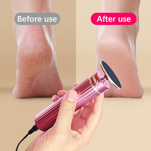 5.3'' Electric Foot Callus Remover with 80pcs Sandpaper Discs & Brush, Professional Aluminum Ergonomic Pedicure Tool, Stepless Speed & Reverse Control for Dead Skin Removal (Pink)