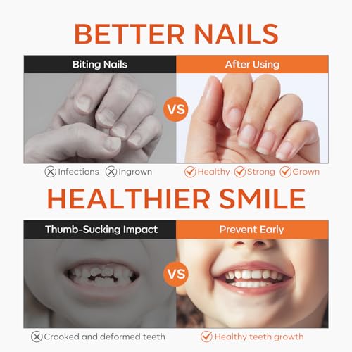 modelones Nail Biting Treatment for Kids Thumb Sucking Deterrent Quick Dry Nail Biting Prevention Bitter No Bite Nail Polish for Nail Care Stop Biting Nails Repair for Damaged Nails 0.34 fl oz
