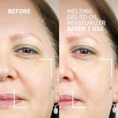 Dr. Brandt Dr. B Lab Melting Gel-to-Oil Moisturizer - Replenish Hydration, Balance Oil Production & Reduce Breakouts - 1.7 fl oz, Pack of 2