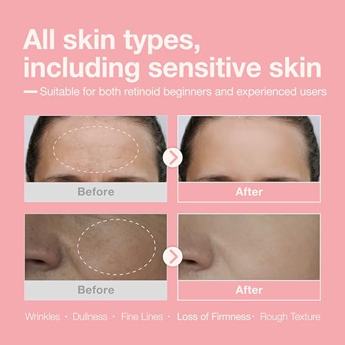 Retinol + Retinal + Peptide Booster Serum ? 1,000ppm Retinol, 100 ppm Retinal, Anti-Aging Face Serum with Peptides, Hyaluronic Acid, Niacinamide & Collagen, Fragrance-Free, 30ml (1.01 fl oz)