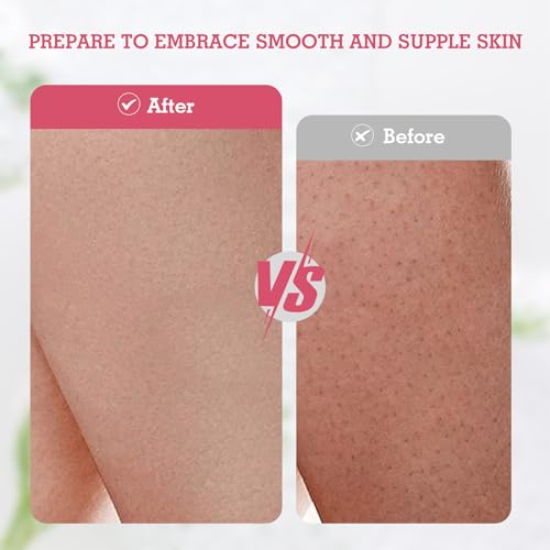 Evridwear Exfoliating Glove Shower Gloves Exfoliate Dead Skin for Dry Sensitive Skin No Irritation with Hanging Loop