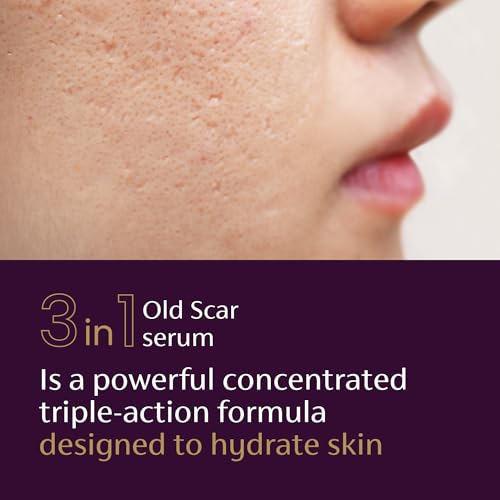 Mederma Scar Serum ? Triple-Action Formula with Vitamin E, Hyaluronic Acid & Niacinamide ? Clinically Shown to Reduce Old Scars, 1 Fl. Oz.