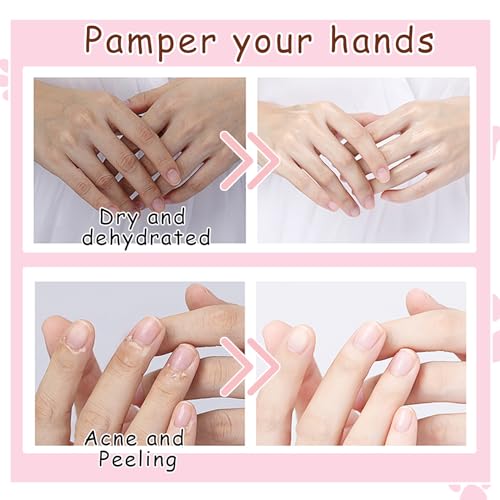 Hand Masks, 6 Pairs Hydrating Exfoliating Hand Peeling Mask, Smooth Hand Masks Moisturizing Gloves Overnight for Dry, Rough, Cracked Hands, Hand Skin Moisturizer Glove for Women Men£¨A