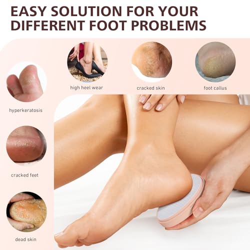 BALUCA Glass Foot File Callus Remover for Feet - Nano Glass Foot Scraper Scrubber Dead Skin Removal for Cracked Heels,Professional Pedicure Tool for Home, Salon, and Travel (Apricot)