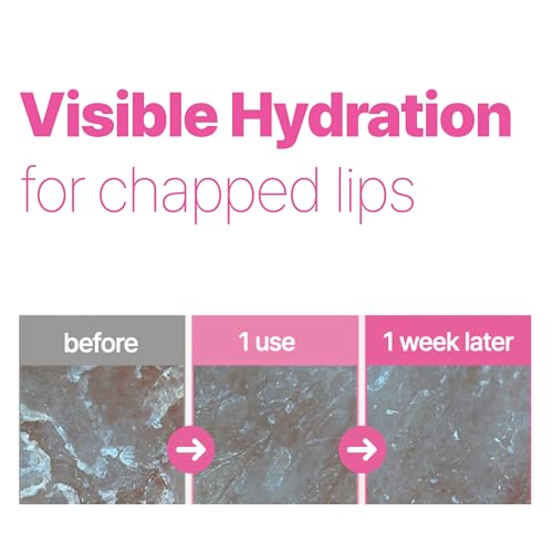 ISOI Refresh Lip Sleeping Mask, Overnight Hydrating Lip Treatment with 4X Ceramide & Botanical Oils, Korean Lip Care (0.88 oz, 25g)