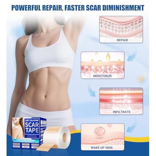 Medical Grade Silicone Scar Sheets & Tape - 1.6¡±x60" Roll, Ultra Soft, Hypoallergenic Rolls for Surgical, Keloid Scars, Tummy Tuck, C-Section, Stretch Marks, Burn & Bumps Scar Removal, 24H Comfortable