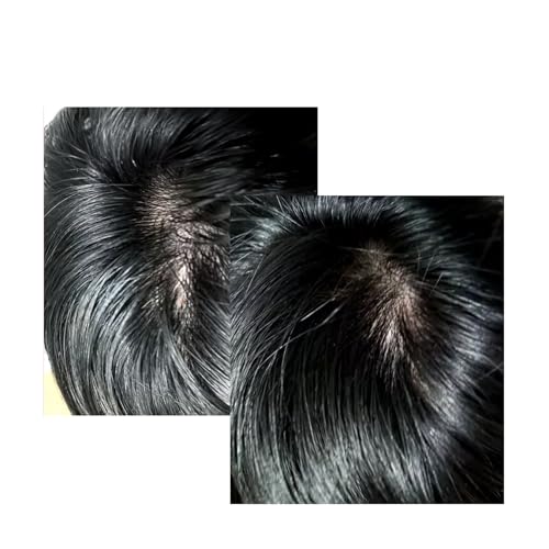 CELONIA NGF 574H Hair Tonic, Korean Primed Bio Stem Cell Hair And Scalp Treatment Serum For Hair Growth And healthy Scalp, Non Greasy Non Oily, Anti Hair Loss, Reduce Flaky Itchy And Dry Scalp 50ml