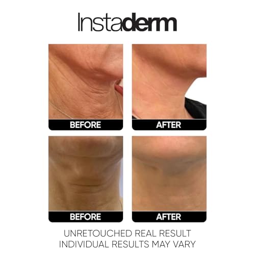 Neck and D?collet? Firming Cream ? Tightening & Lifting Treatment for Crepey, Wrinkles, sagging Skin & Vertical Lines. Anti-Aging Peptide Formula to Boost Hydration & Collagen in the Skin.