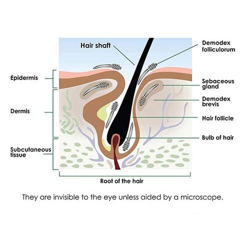 Ungex Demodex Defence Cleanser | Face, Scalp and Body Wash | Herbal Based | DDC