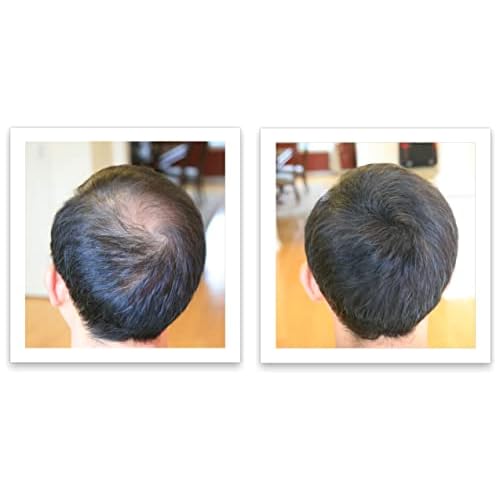 Caboki 10X Volumizing Hair Powder for Thinning Hair: Root Touch Up for Men and Women, Fill in Hairline & Edges, Cover Bald Spots. TALC-Free, Dark Gray